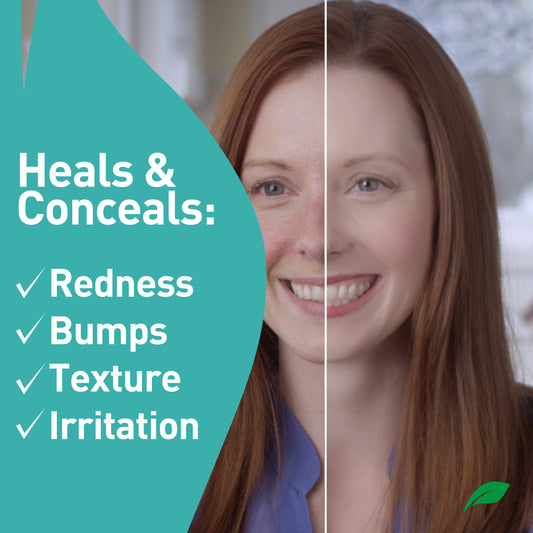 PROcure Rosacare Medicated Redness Reduction CC Face Cream - 2 Pack