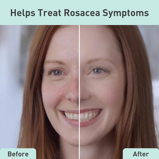 PROcure Rosacare Medicated Redness Reduction CC Face Cream 2 Ounce